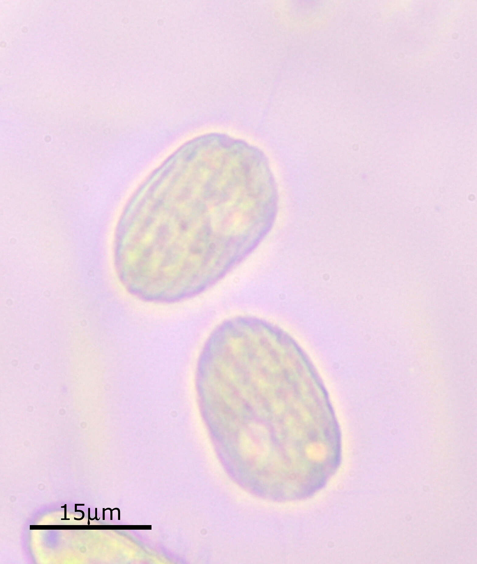 Image of Cinetochilum margaritaceum