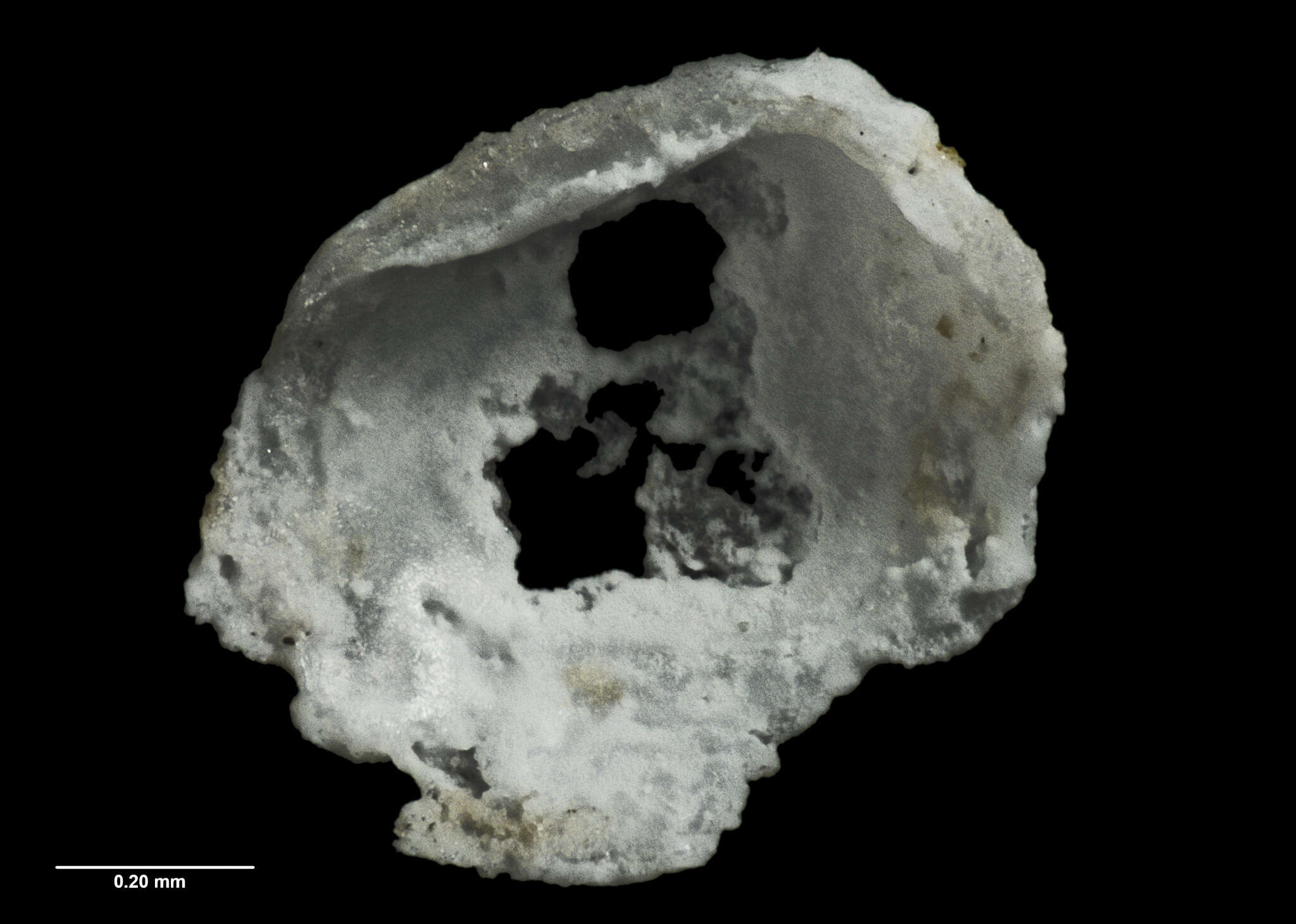 Image of Benthocardiella obliquata chathamensis Powell 1933