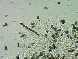 Image of mycocalicium lichen