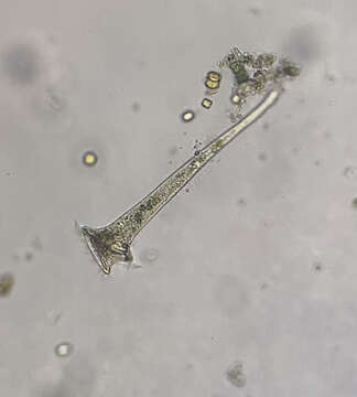 Image of Stentor roeselii