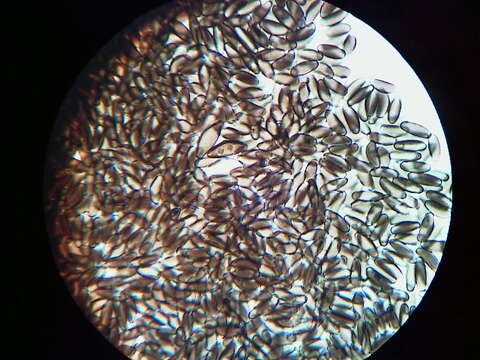 Image de Pyrenomyxa picea (Ellis) M. Stadler, Læssøe & Lar. N. Vassiljeva 2006