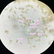 Image de Mallocybe multispora