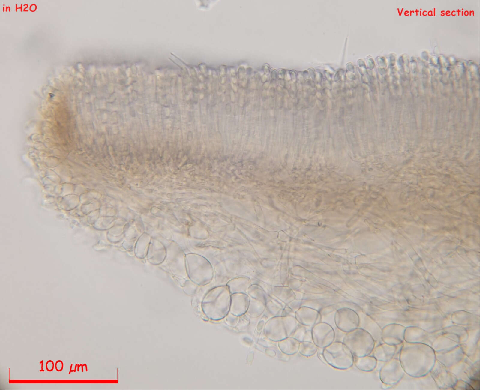 Image of Moellerodiscus capillipes (Quél.) M. P. Sharma 1986