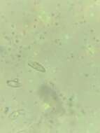 Image de Anisomeridium biforme (Borrer) R. C. Harris