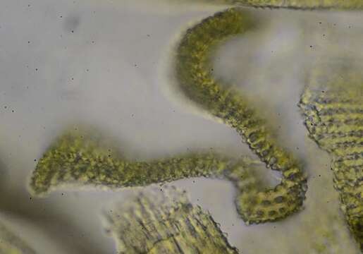 Image of racomitrium moss