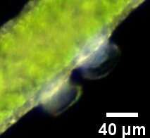 Sivun Trichodina pediculus kuva