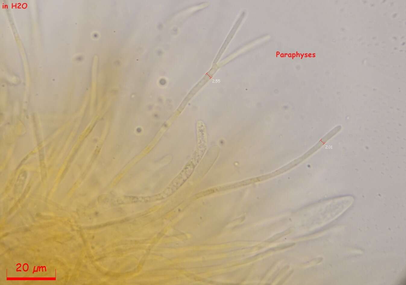 Image of Parachnopeziza miniopsis (Ellis) Korf 1978