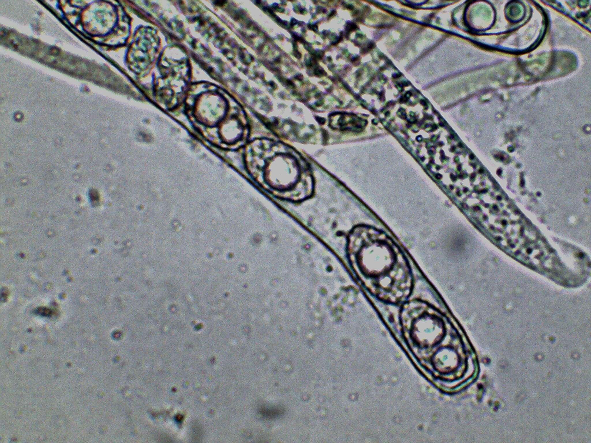 Imagem de Pachyella celtica (Boud.) Häffner 1993