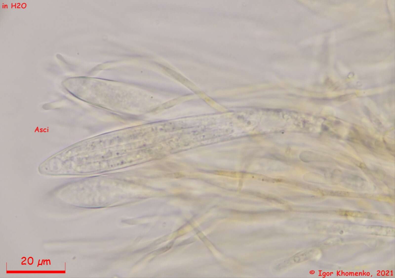 Image of Parachnopeziza miniopsis (Ellis) Korf 1978