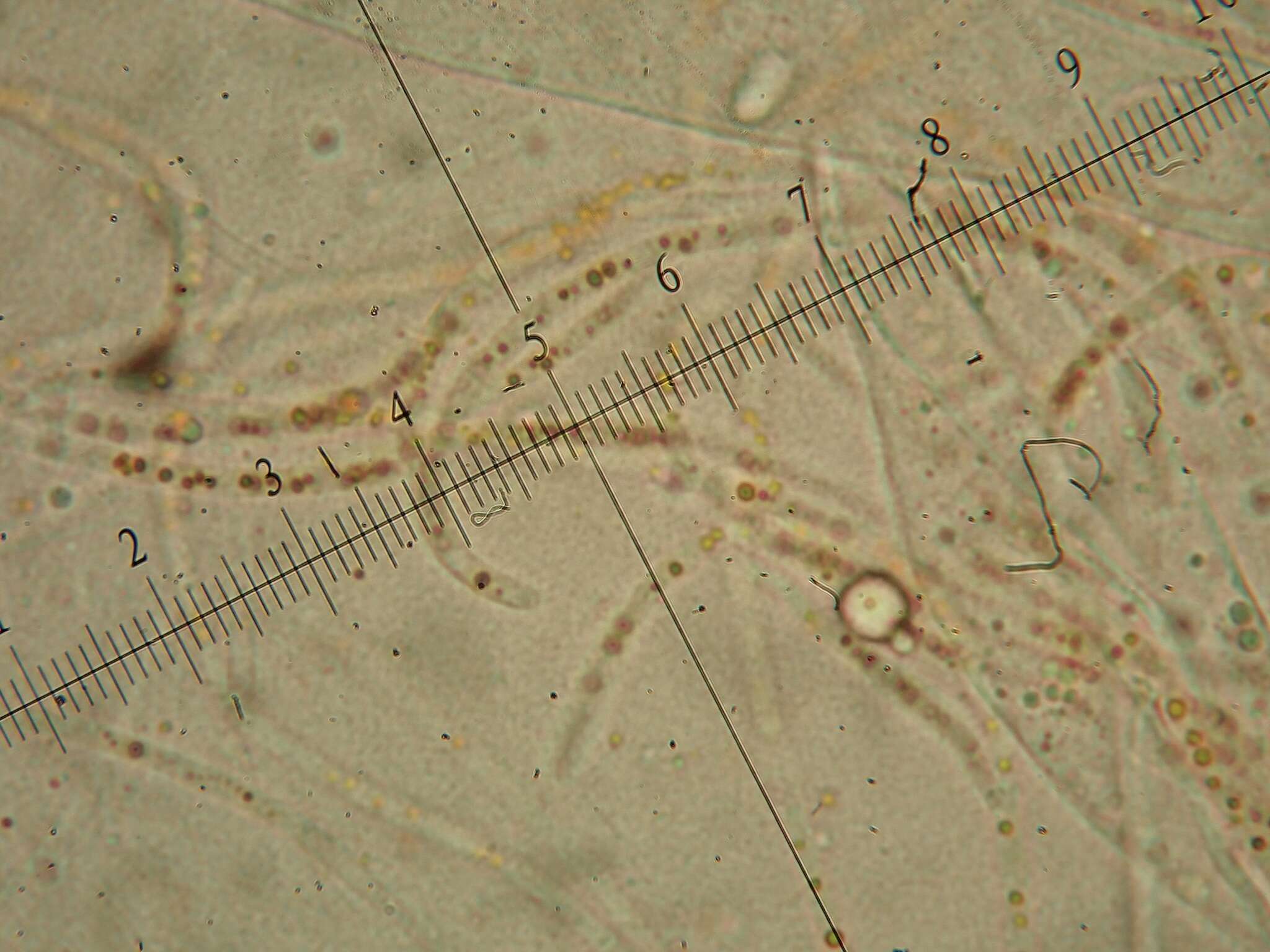 Sivun Pulvinula convexella (P. Karst.) Pfister 1976 kuva