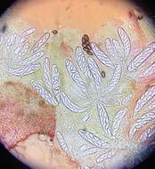 Слика од Ascobolus americanus (Cooke & Ellis) Seaver 1928