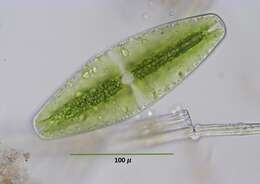 Netrium (Naegeli) Itzigsohn & Rothe 1856的圖片