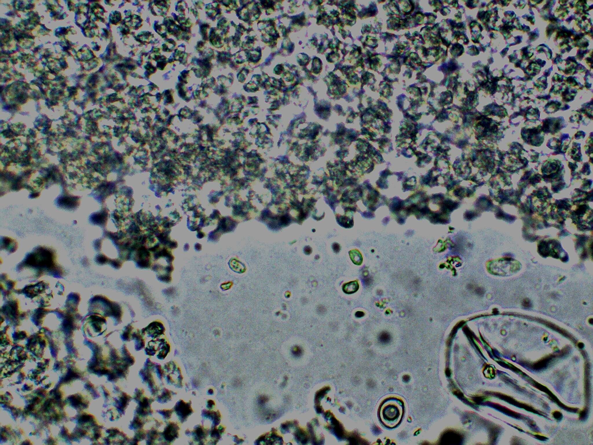 Image of Cystolepiota seminuda (Lasch) Bon 1976