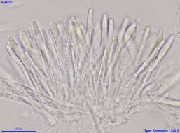 صورة Tapesia lividofusca (Fr.) Rehm 1891