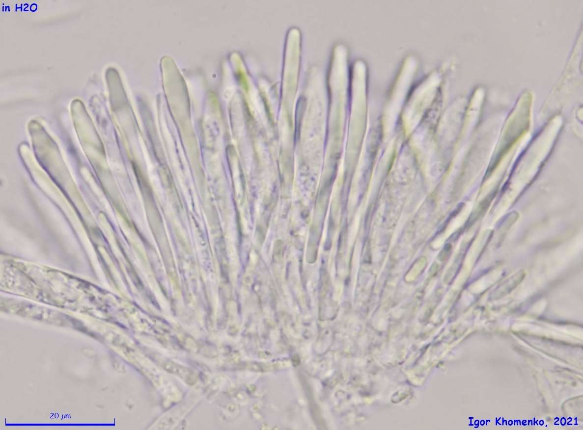 صورة Tapesia lividofusca (Fr.) Rehm 1891