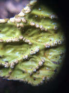 Image of lung lichen