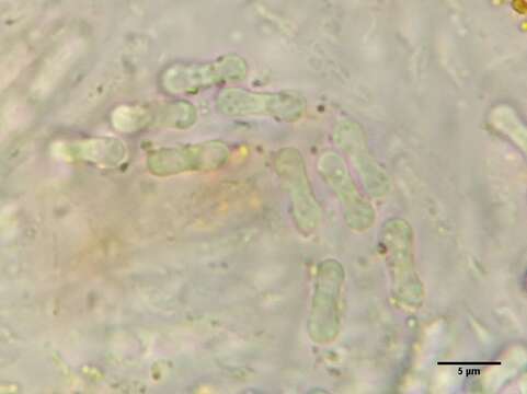 Imagem de Bryocentria brongniartii (P. Crouan & H. Crouan) Döbbeler 2004