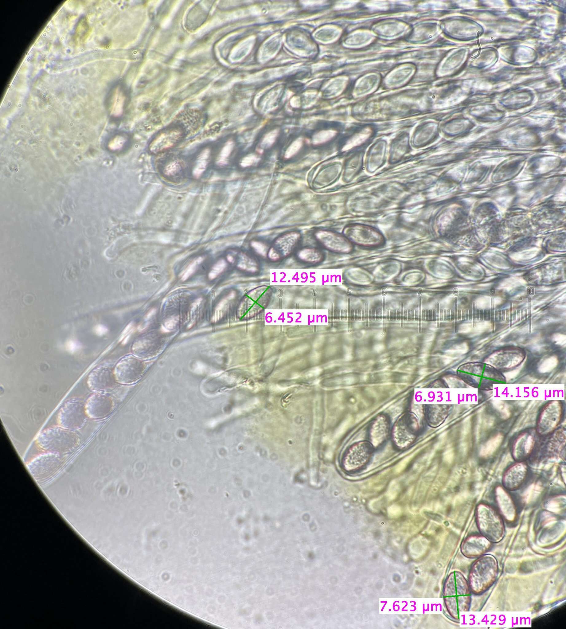 Image de Ascobolus lineolatus Brumm. 1967