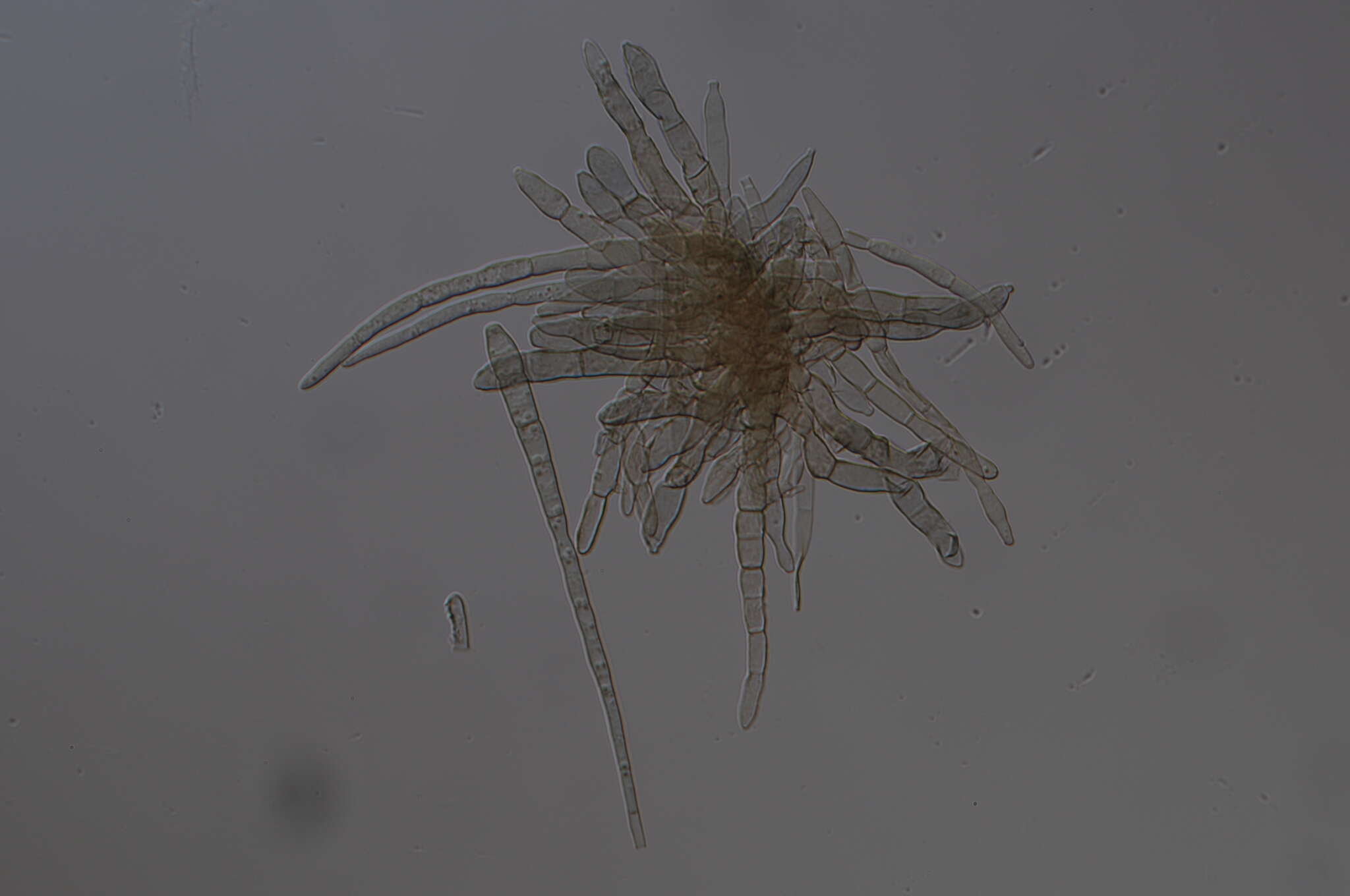 Image of Pseudocercospora rhinacanthi (Höhn.) Deighton 1976