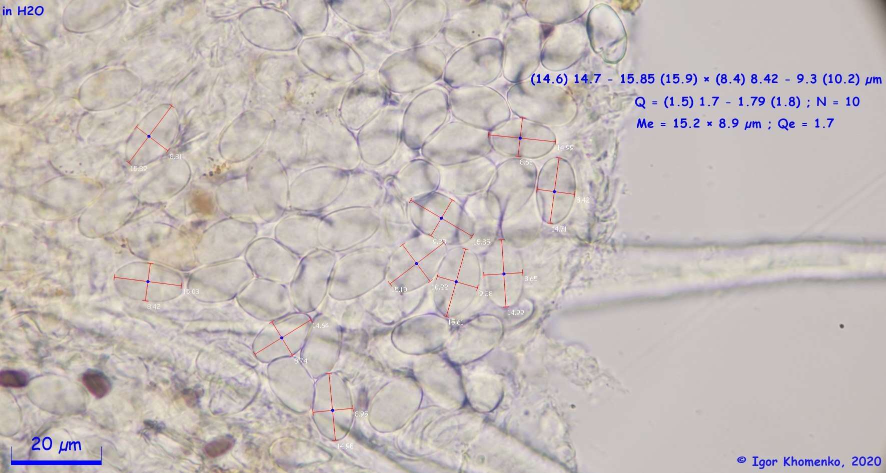 Imagem de Lasiobolus intermedius J. L. Bezerra & Kimbr. 1975