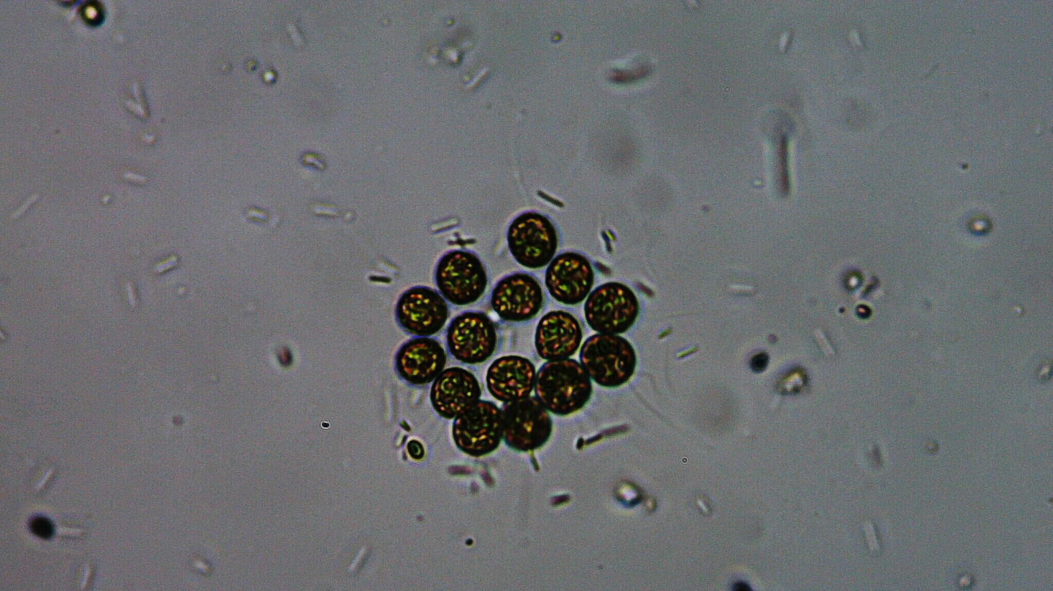 gonium under microscope