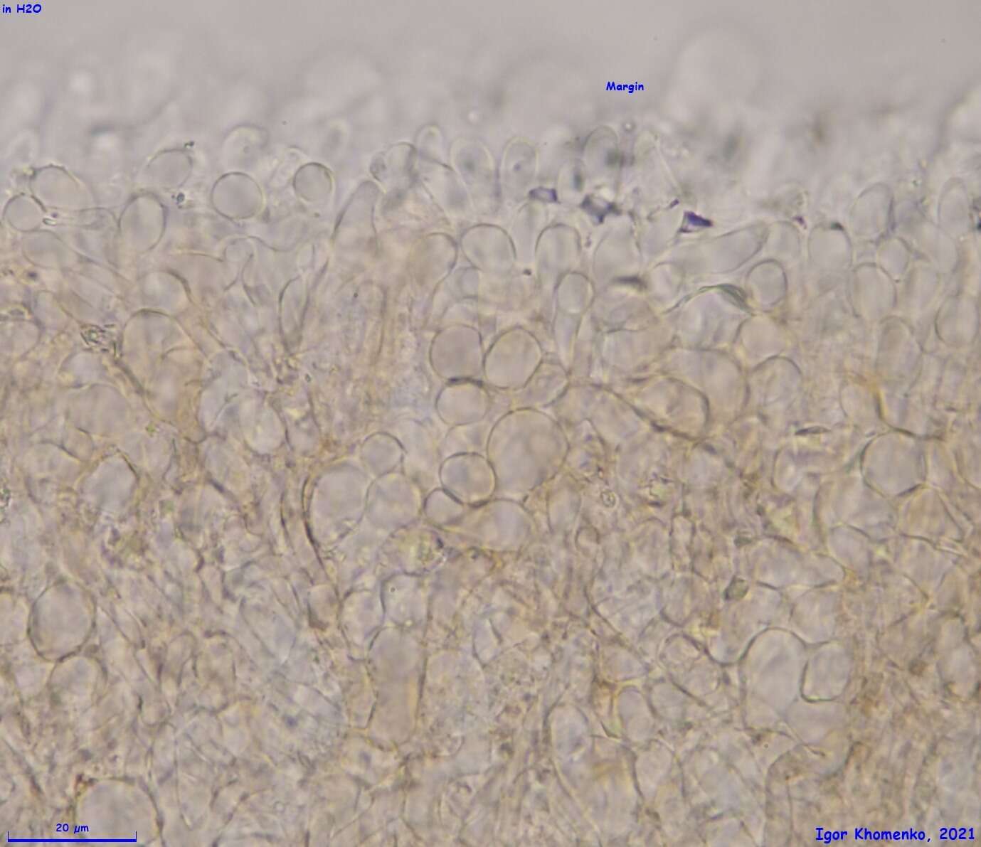 Image of Moellerodiscus capillipes (Quél.) M. P. Sharma 1986