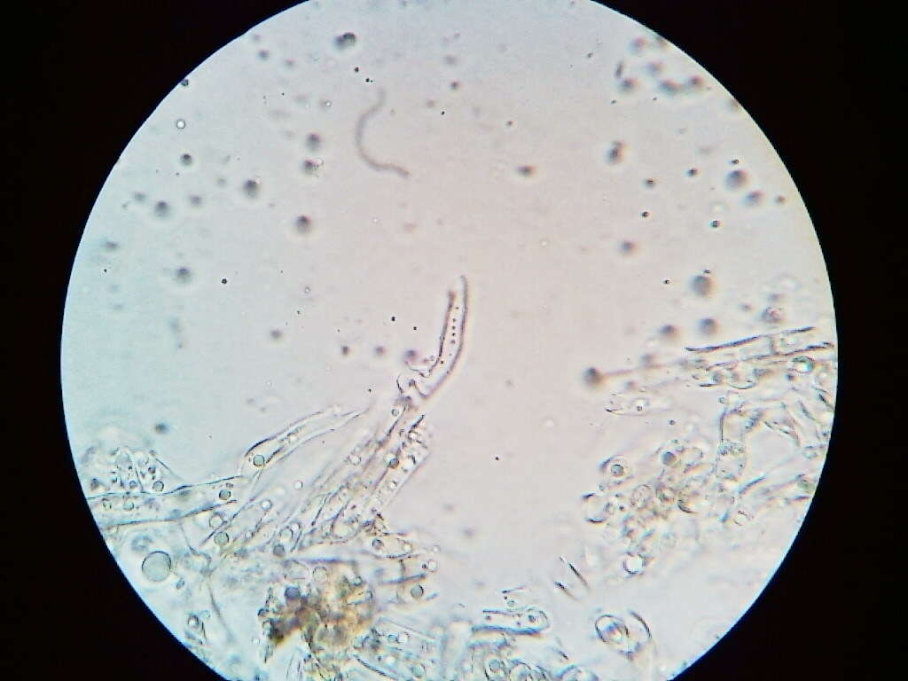 Cylindrobasidium laeve (Pers.) Chamuris 1984 resmi