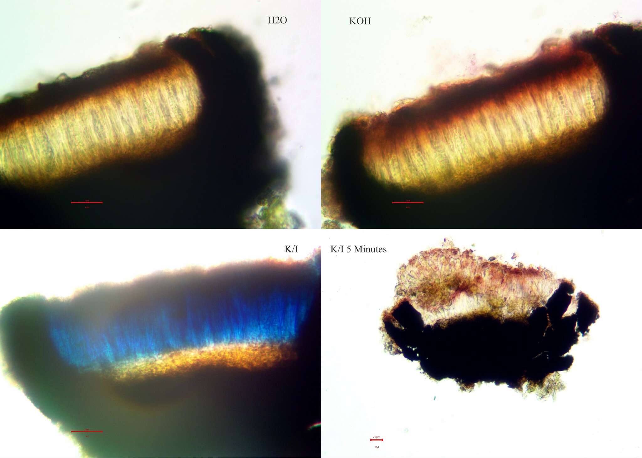 Image de Alyxoria ochrocheila (Nyl.) Ertz & Tehler