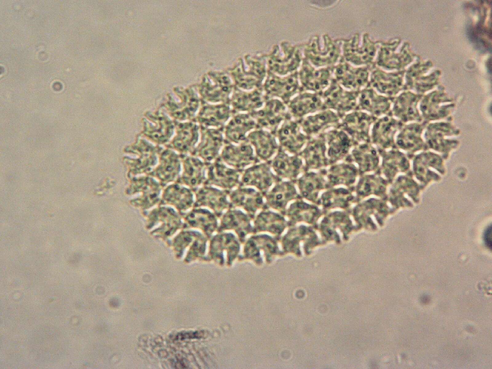 Plancia ëd Pediastrum angulosum