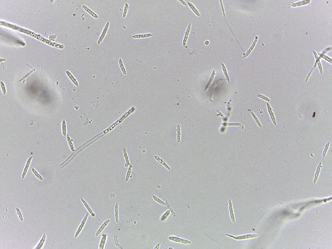 Image of Lichtheimiaceae