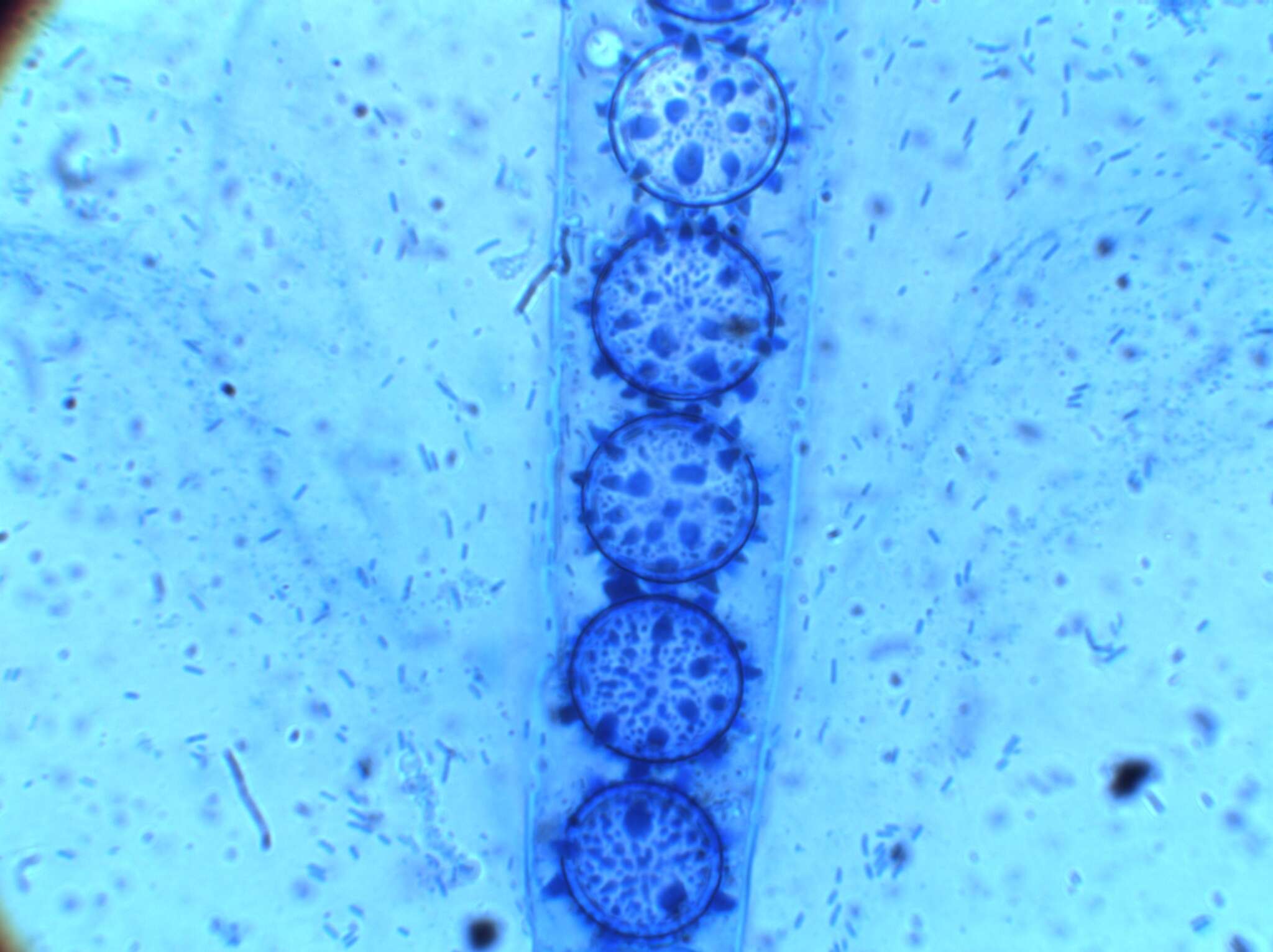 Image of Scutellinia legaliae Lohmeyer & Häffner 1983