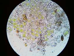 Image of phaeocalicium lichen