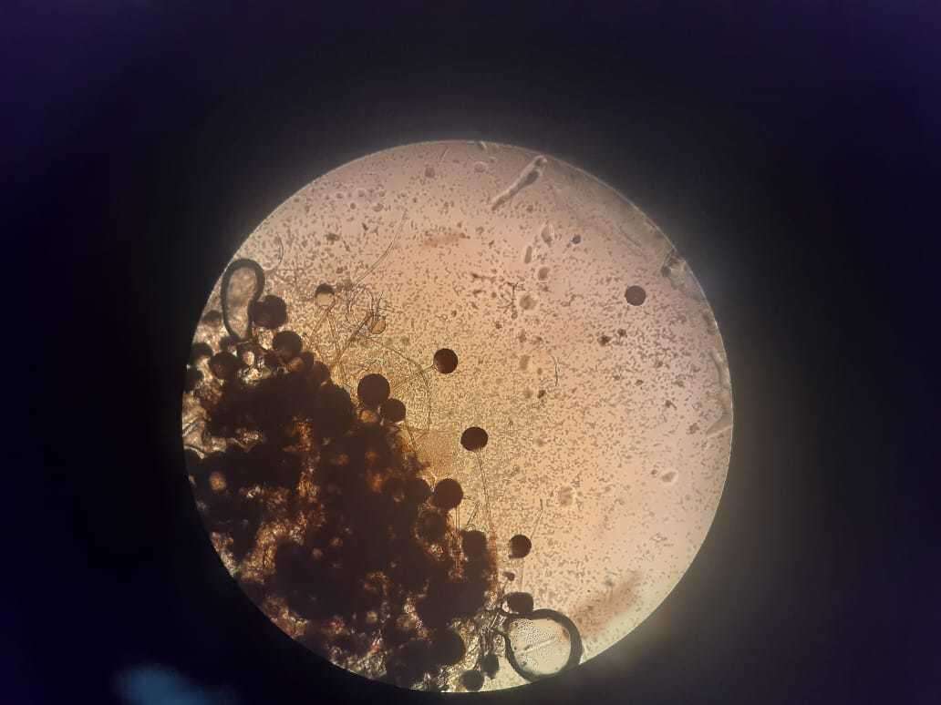 Image of Rhizopus stolonifer (Ehrenb.) Vuill. 1902