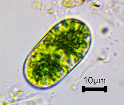 صورة Cylindrocystis brebissonii