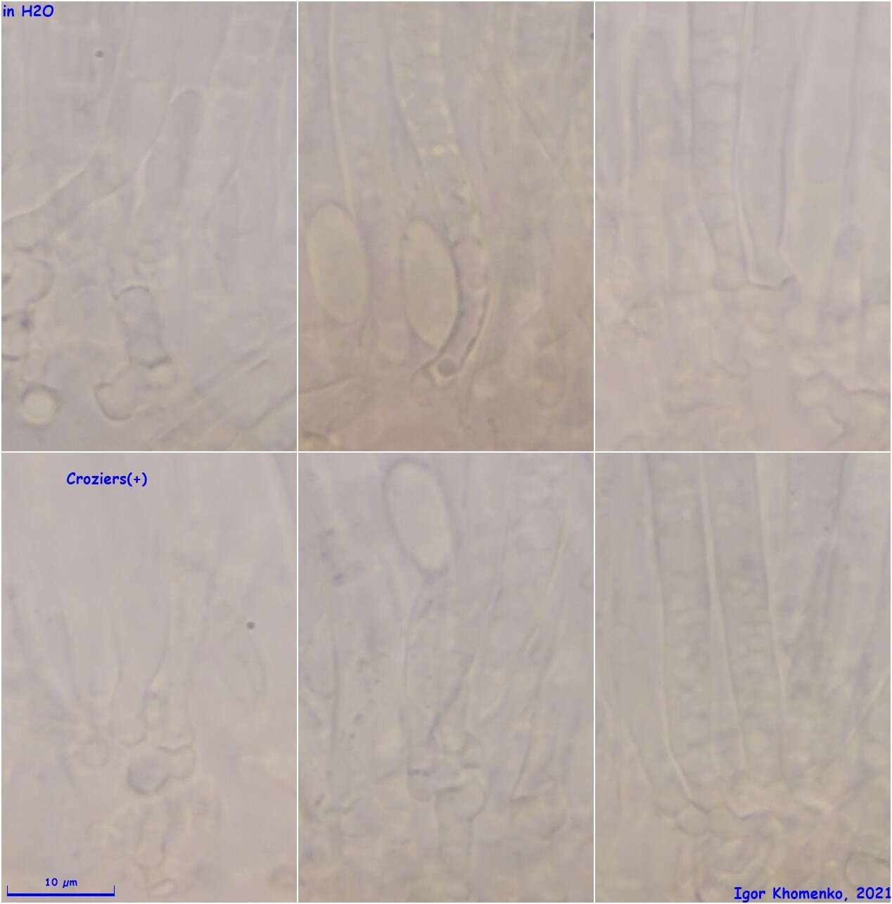 Image of Moellerodiscus capillipes (Quél.) M. P. Sharma 1986