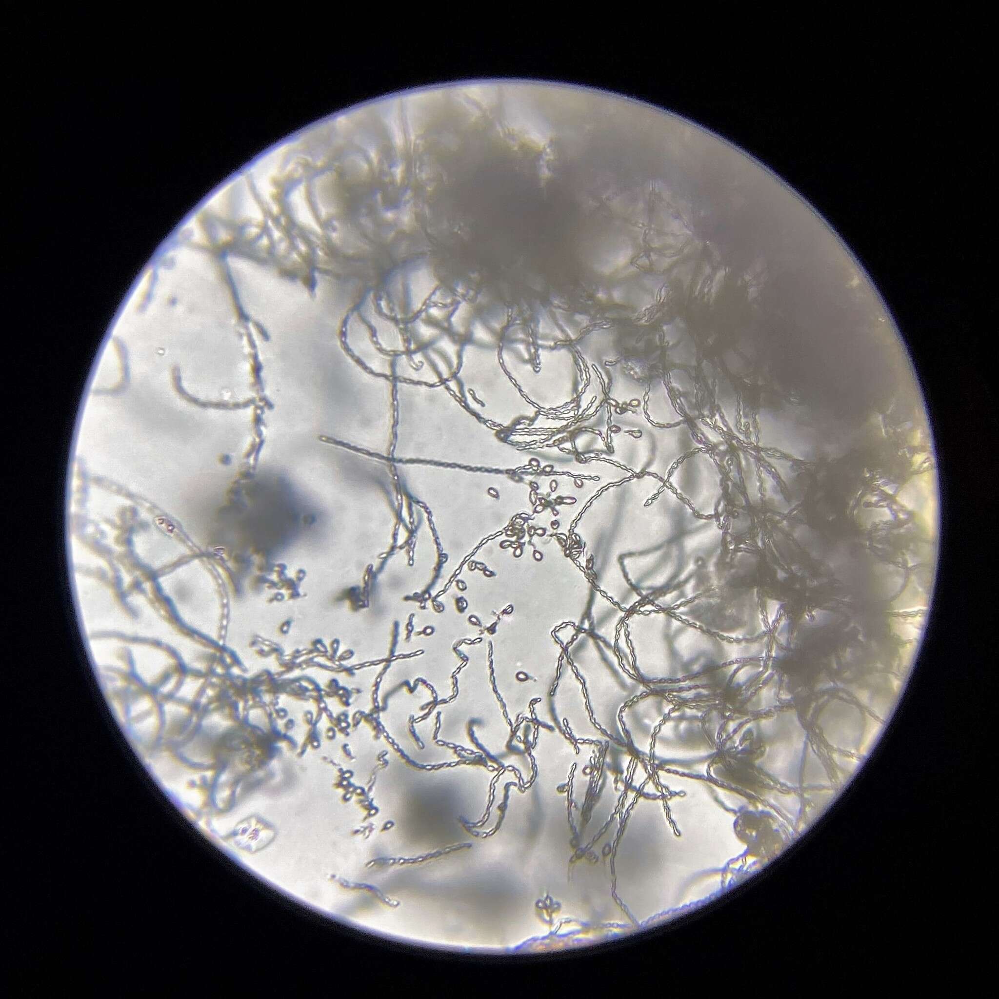 Image of Aspergillus flavipes (Bainier & R. Sartory) Thom & Church 1926