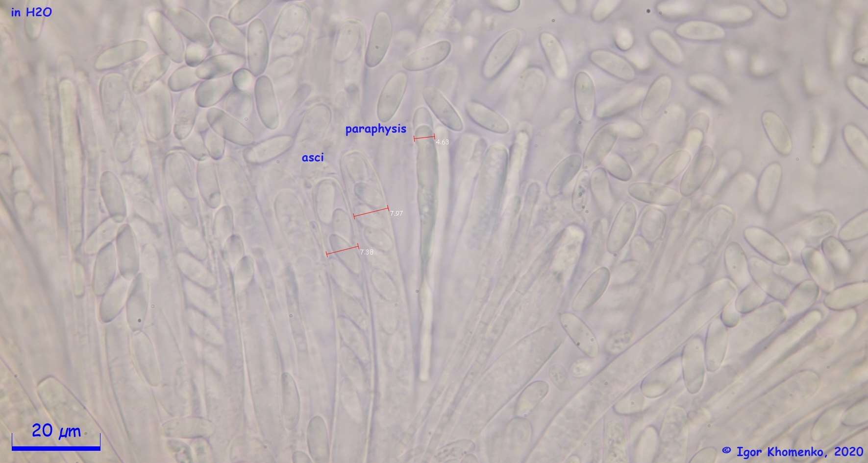 صورة Ciborinia pseudobifrons Whetzel ex J. W. Groves & Bowerman 1955