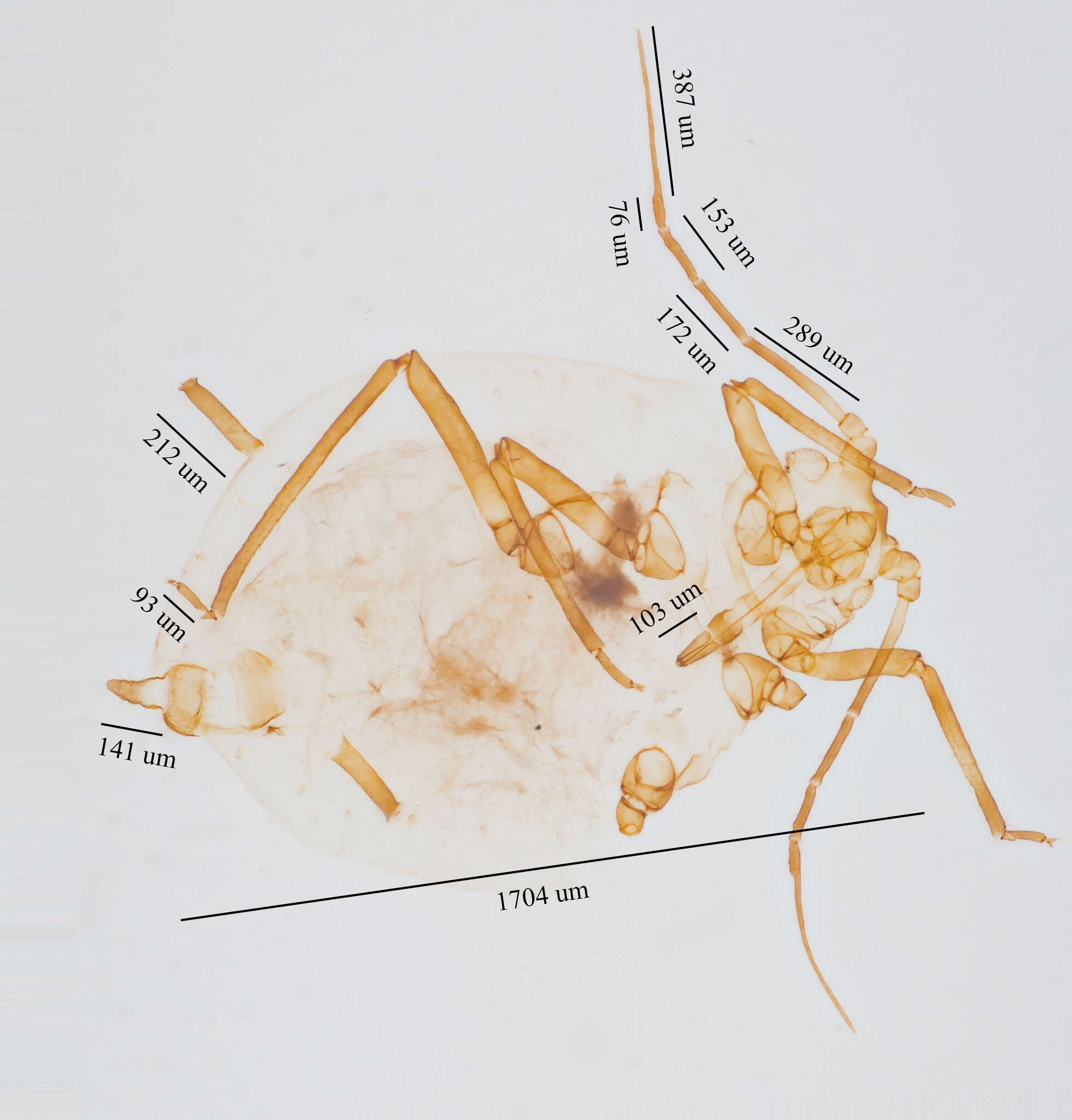 Image of Oat-birdcherry aphid