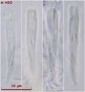 Image of Orbilia sinensis (Z. F. Yu & K. Q. Zhang) Baral, Z. F. Yu & E. Weber 2015