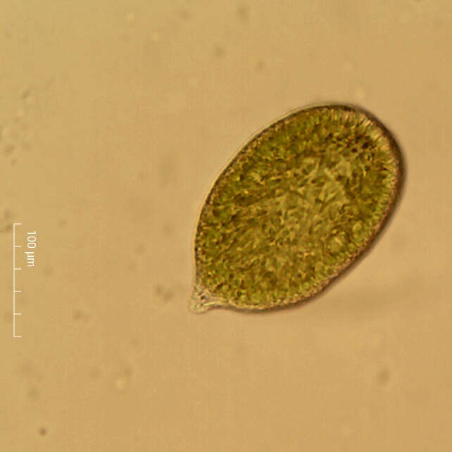 Image de Gonyostomum semen