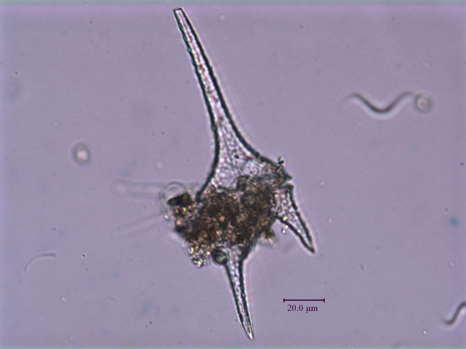 Image of Ceratium rhomvoides Hickel 1987