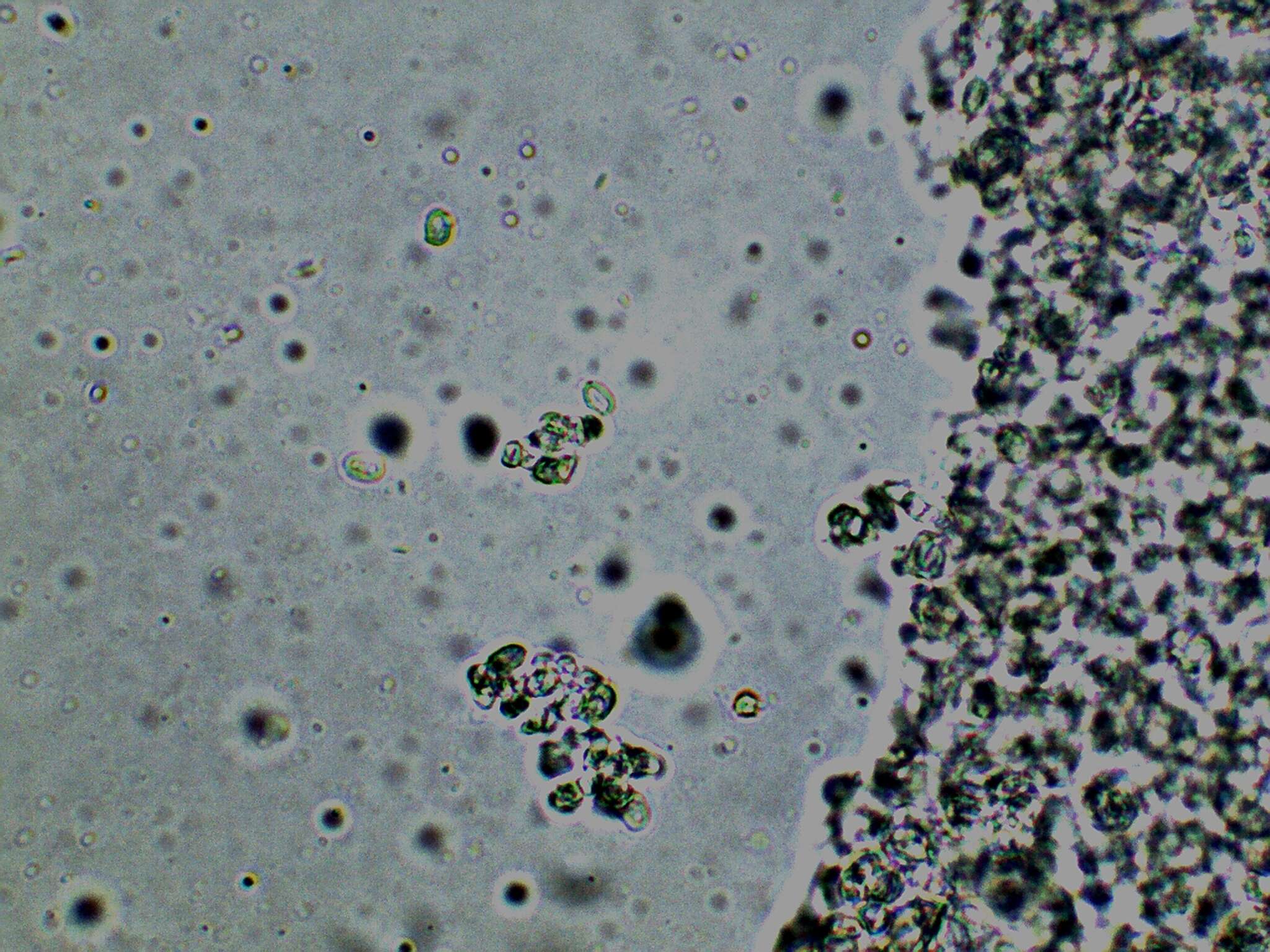 Image of Cystolepiota seminuda (Lasch) Bon 1976