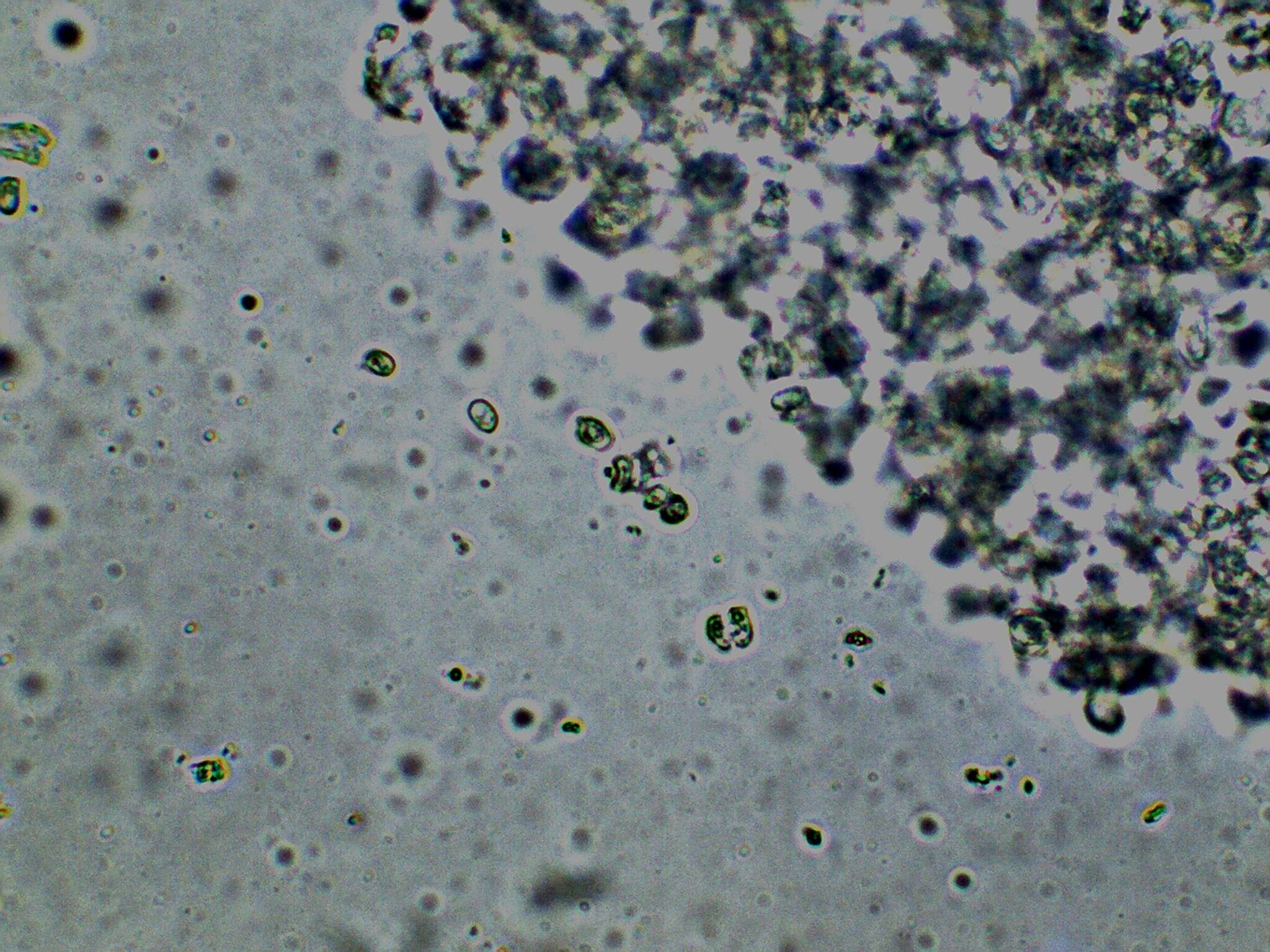 Image of Cystolepiota seminuda (Lasch) Bon 1976