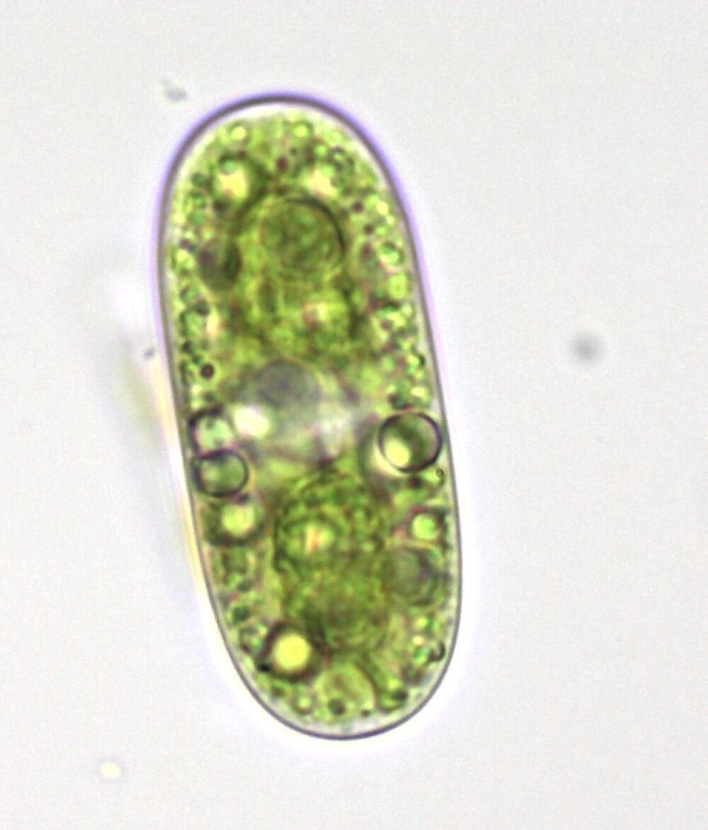 Image of Cylindrocystis brebissonii