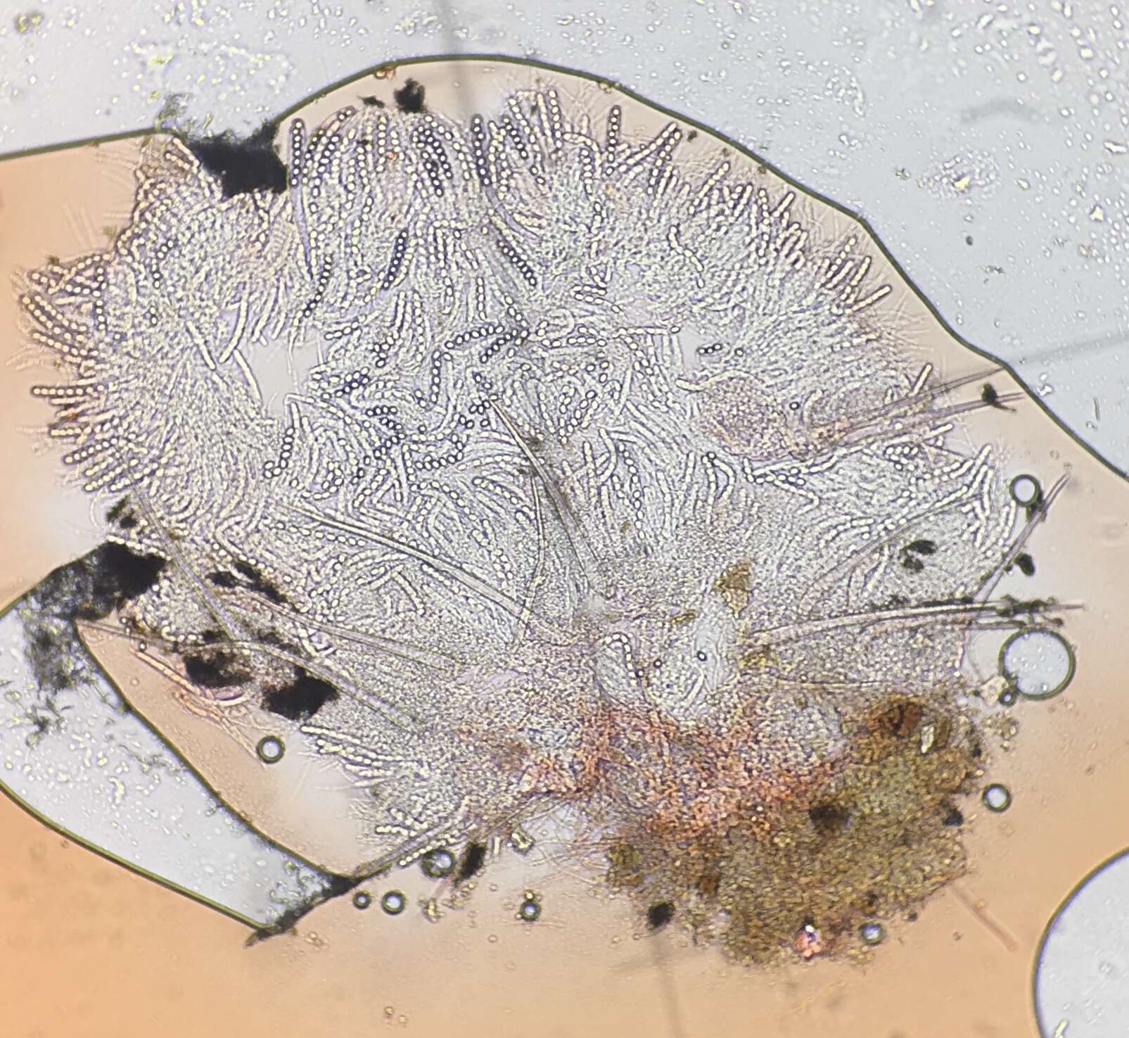 Image de Lasiobolus microsporus J. L. Bezerra & Kimbr. 1975