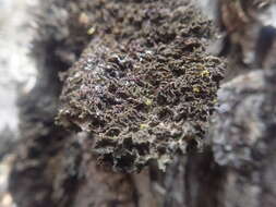Image of skin lichen
