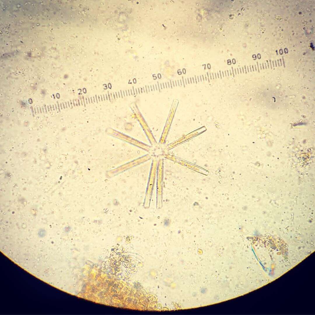 Thalassionema nitzschioides的圖片