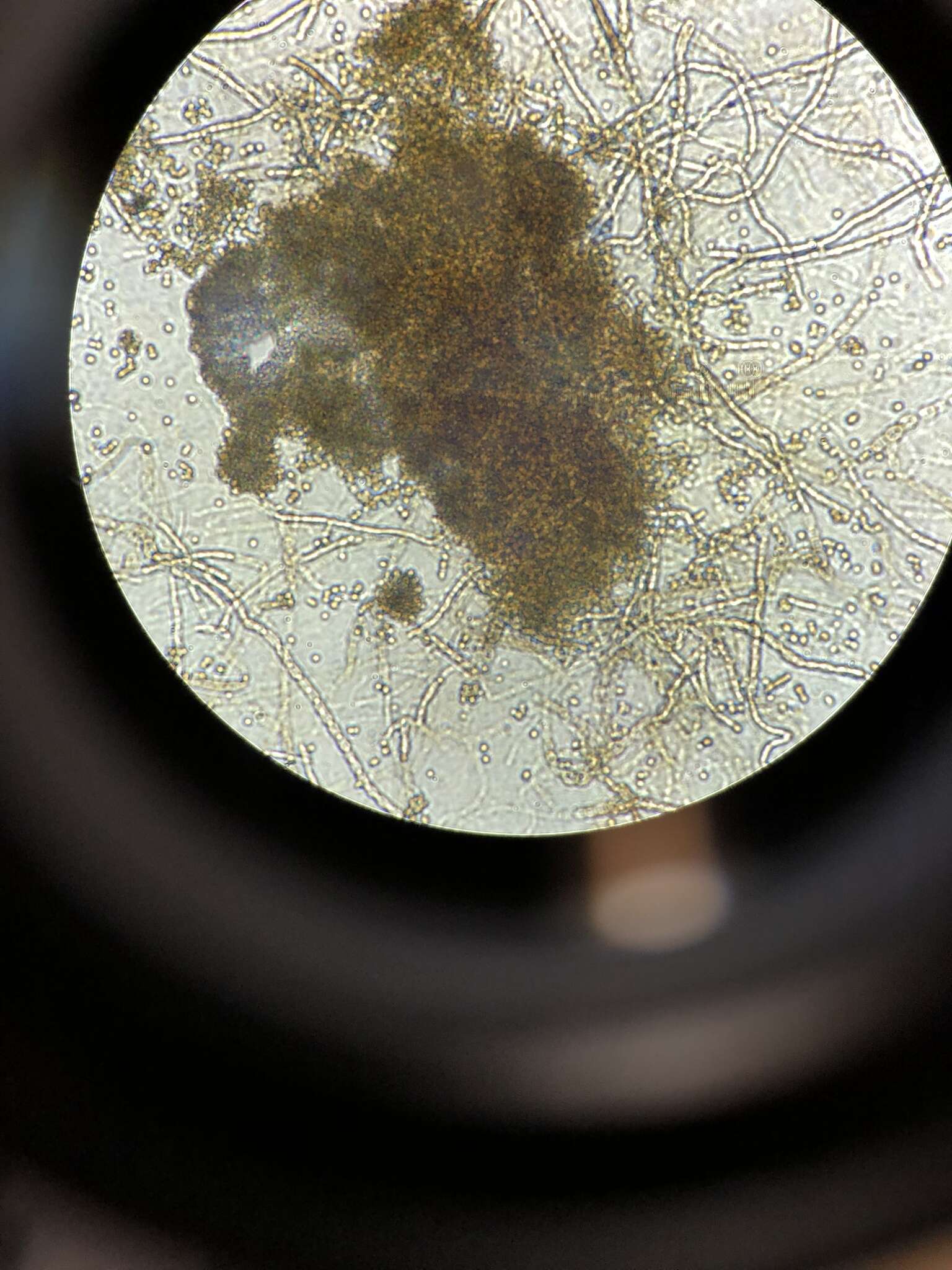 Image of Cladosporium austrohemisphaericum Bensch, Crous & U. Braun 2015