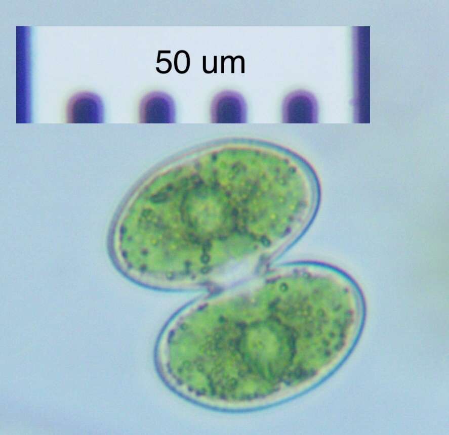 Image of Cosmarium contractum