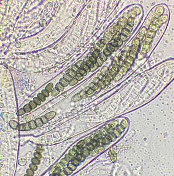 Слика од Sporormiella vexans (Auersw.) S. I. Ahmed & Cain 1972